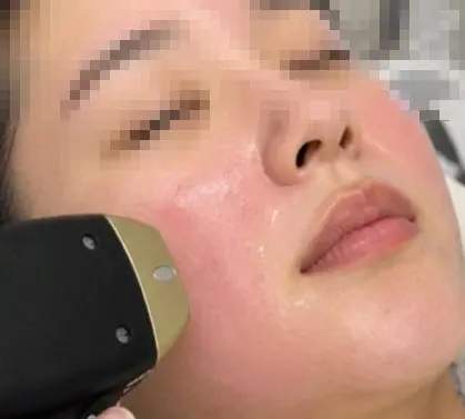 予約前に確認しておきたい4つのこと